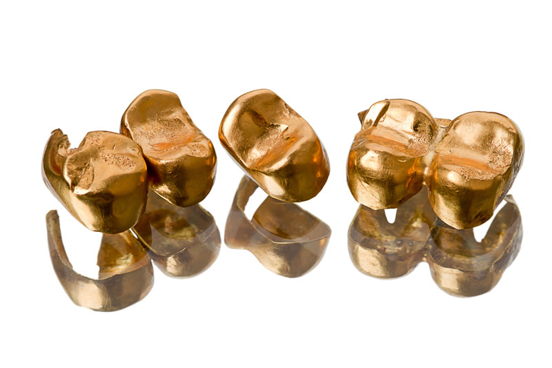 Zahngold für den Ankauf