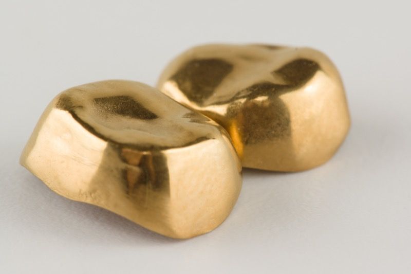 Wie wertvoll ist Zahngold